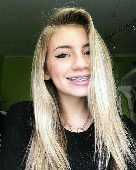 blonde girl with braces|braces are pretty